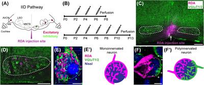 Microglia Regulate Pruning of Specialized Synapses in the Auditory Brainstem